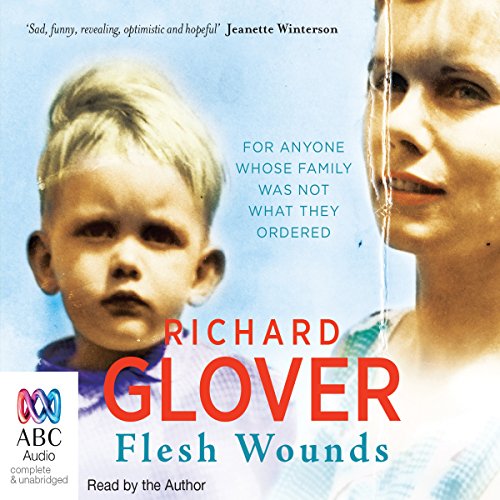Flesh Wounds AUDIOBOOK by Richard Glover